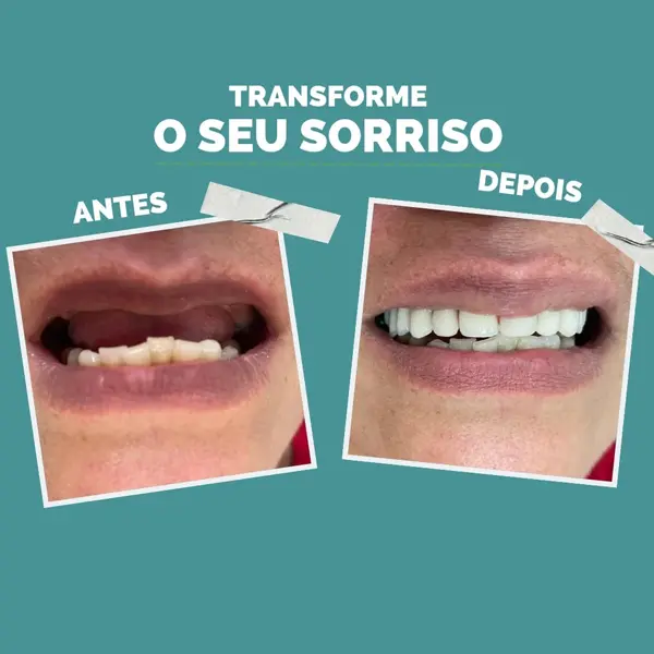 foto-galeria